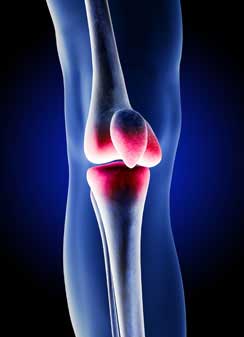 Columbus DePuy Knee Attorney